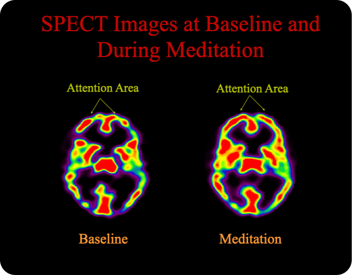 brain scan 1