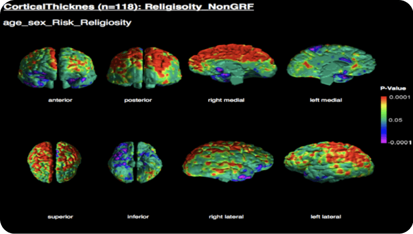 brain scan 2