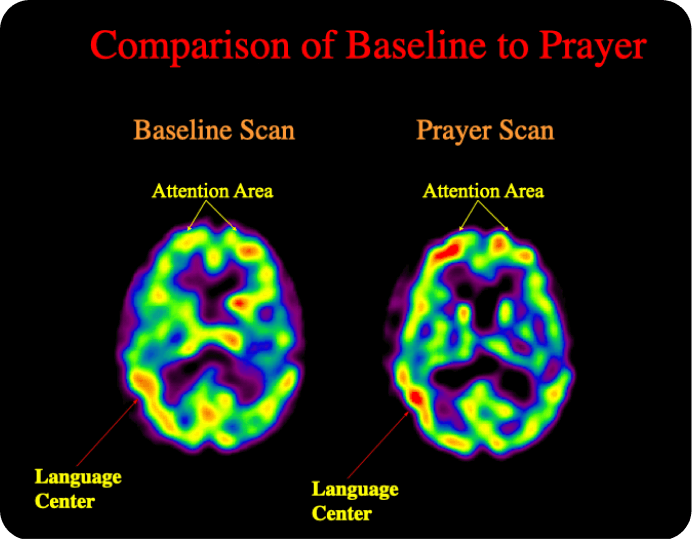 brain scan 3