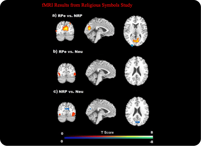 brain scan 4